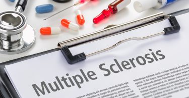 multiple sclerosis