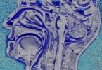 fMRI study on MDMA for PTSD