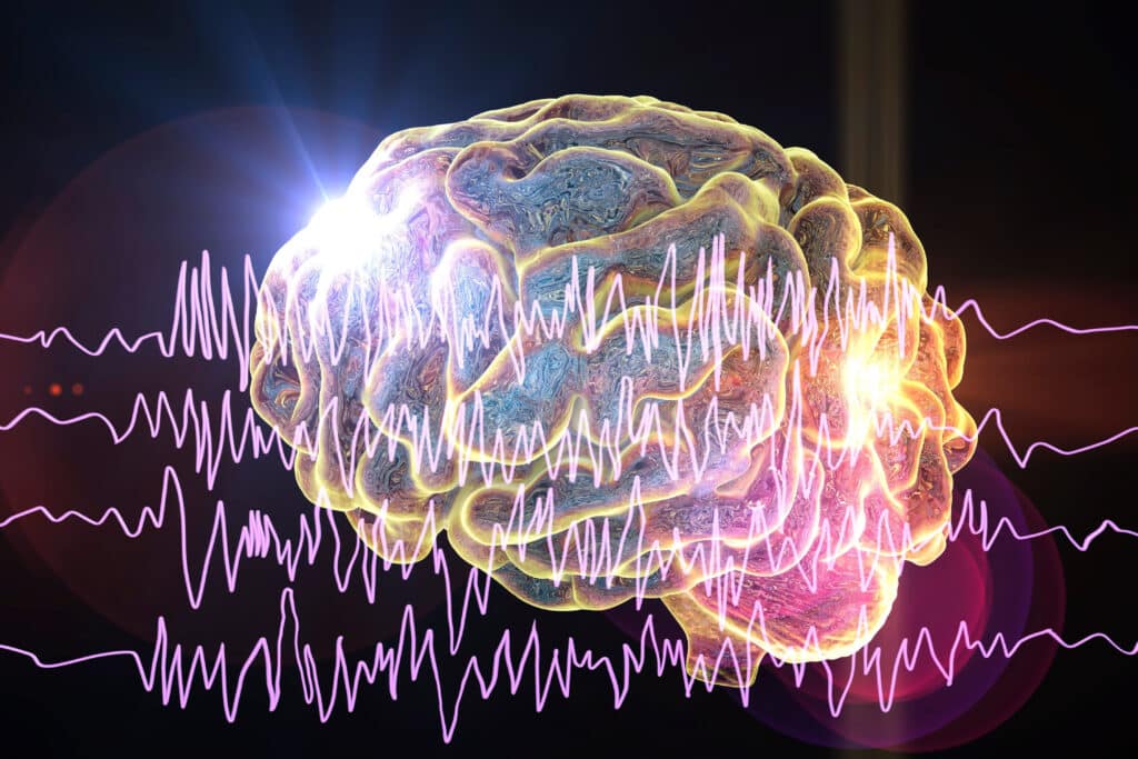 EEG technology measures brain waves