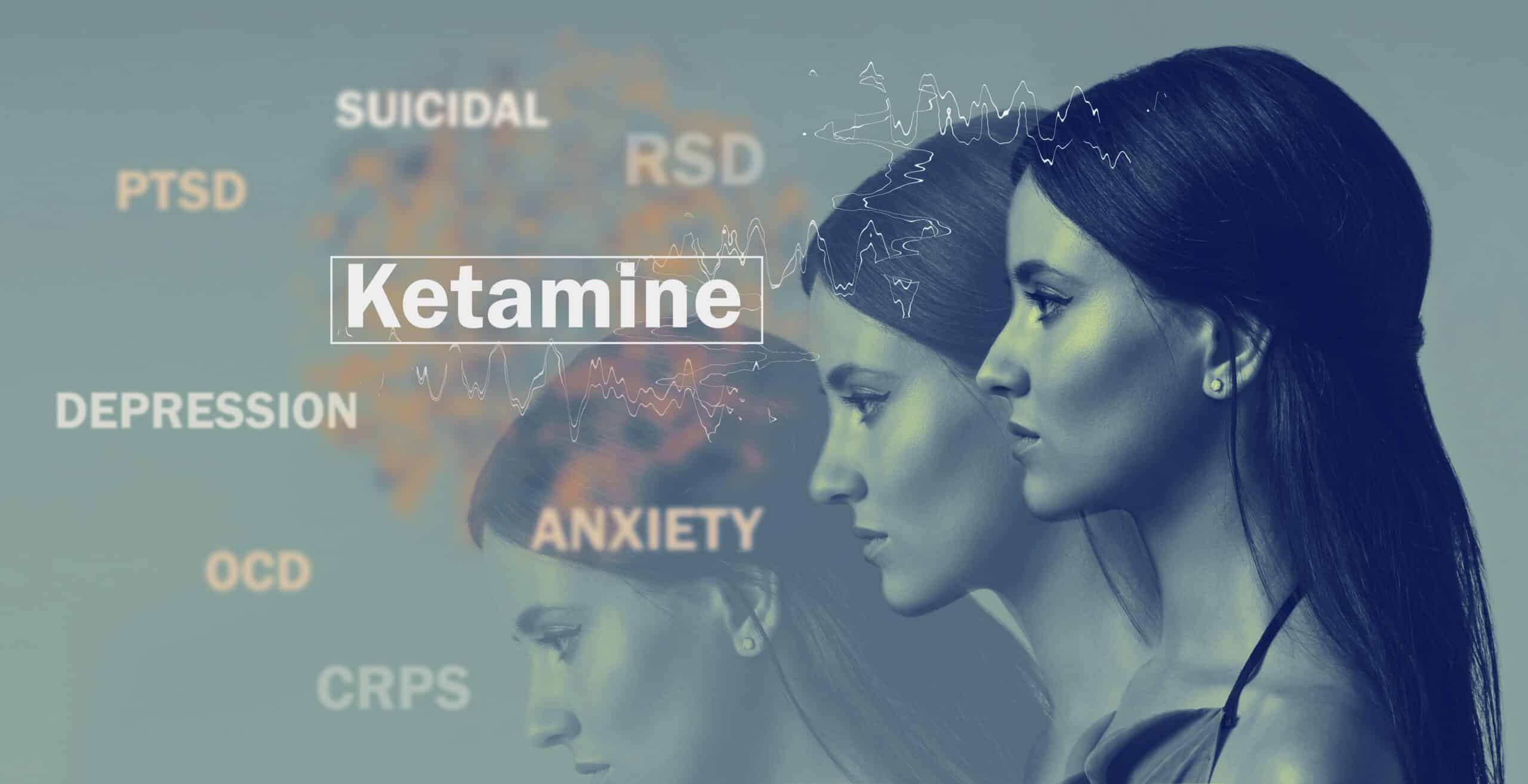 New Study Tests Slow-Release Ketamine For Depression Treatment